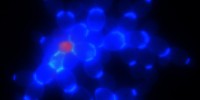image: Multicellular Yeast