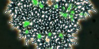 A yeast cluster with apoptotic cells shown in green. 