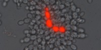 A yeast cluster with dead cells stained red with propidium iodide