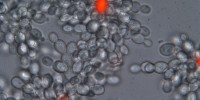 Multicellular yeast with red dead cells