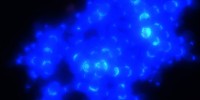 A yeast cluster with the cell walls stained with the blue dye calcofluor.