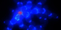 A yeast cluster with the cell walls stained with blue dye and a dead cell shown in red