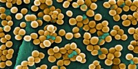 image: Antimicrobial Cross-Resistance Risk