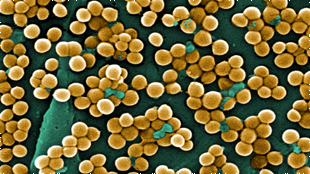 Antimicrobial Cross-Resistance Risk image: Antimicrobial Cross-Resistance Risk