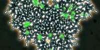 A yeast cluster with apoptotic cells shown in green.