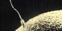 image: Ultrasound Halts Sperm Production