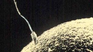 Ultrasound Halts Sperm Production image: Ultrasound Halts Sperm Production