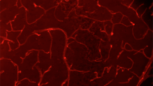 Low Oxygen Saves Irradiated Brain? image: Low Oxygen Saves Irradiated Brain?
