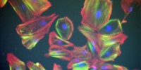 Vascular smooth muscle cells differentiated from human embryonic stem cells stained for DNA (blue) and the smooth muscle markers smoothelin (red) and caldesmon (green).Leslie Caron, GENEA, Australia2011 IN Cell Analyzer Image Competition
