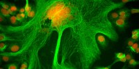Human ovarian cancer cells stained for DNA (red) and microtubules (green). Geoffrey Grandjean, MD Anderson Cancer Center2011 IN Cell Analyzer Image Competition