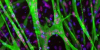 Myoblast stained for DNA (blue), Myosin heavy chain (green) and methylated Histone H4 (red).Marie Neguembor, ALEMBIC - San Raffaele Scientific Institute, Italy2011 IN Cell Analyzer Image Competition