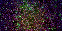 U2OS cells expressing ß-Arrestin2-GFP (green) stained for DNA (blue) and vimentin (red).Anja Klussmeier, Charité, Berlin2011 IN Cell Analyzer Image Competition