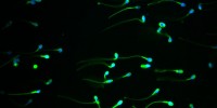 Sperm stained for DNA (blue) and membrane (green).Jesselyn Hu, GENEA, Australia2011 IN Cell Analyzer Image Competition