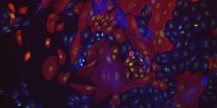 Human breast epithelial cells stained for basal cells (red), luminal cells (blue), and double-stranded DNA damage marker (green).Rebecca Johnston, The University of Queensland Centre for Clinical Research, Australia2011IN Cell Analyzer Image Competition