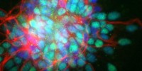 Mouse neural progenitors and differentiated neurons stained for DNA (blue), neuronal ßIII-tubulin (red) and progegenitor Sox2 (green).Giorgio Bergamini, ALEMBIC- San Raffaele Scientific Institute, Italy2011IN Cell Analyzer Image Competition