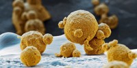image: Opinion: No Objections to Nano?