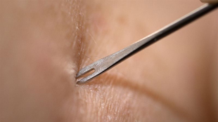 Skin-Deep Immunity image: Skin-Deep Immunity