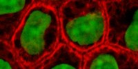 image: Cancer’s First Step