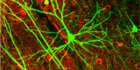 image: Brain Proteins May Be Key to Aging