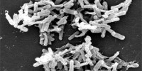 image: <em>C. diff</em> Infection Source Unclear