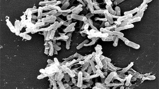 <em>C. diff</em> Infection Source Unclear image: <em>C. diff</em> Infection Source Unclear