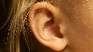 What the Brain Hears image: What the Brain Hears