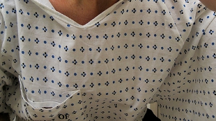 Chemo for Stroke? image: Chemo for Stroke?