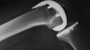 The Implant Melting Pot image: The Implant Melting Pot