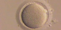 image: Ovarian Stem Cells in Humans?