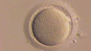 Ovarian Stem Cells in Humans? image: Ovarian Stem Cells in Humans?