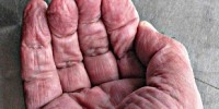 image: A Mammalian Longevity Gene?