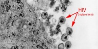 The electron microscope thus became a powerful in the field of virology, since viruses were for the most part too small to be visualized by conventional optical microscopes. This is one of the earliest electron micrographs showing the mature form of the human immunodeficiency virus (HIV), taken in 1983.CDC
