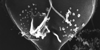 This scanning electron micrograph shows a Giardia lamblia protozoan during the process of cell divisionCDC