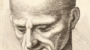 Baldness Genes Discovered? image: Baldness Genes Discovered?