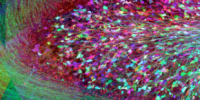 image: Cerebral Beauty