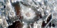 image: Collecting Cancer Data