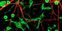 image: Immune Role in Brain Disorder?
