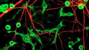 Immune Role in Brain Disorder? image: Immune Role in Brain Disorder?