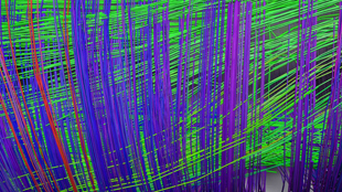 Parallel brain fibers in two directions are shown in contrasting colors