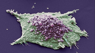 News from Cancer Meeting image: News from Cancer Meeting