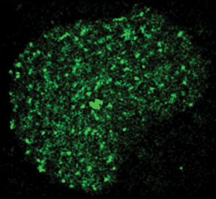 LIGHTING UP RNA: Bacteriophage MS2 coat protein fused with GFP binds to mRNAs containing copies of the MS2’s RNA-binding sequence in the nucleus of cultured cells.