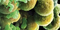 image: Are Cancer Stem Cells Ready for Prime Time?