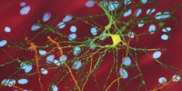 image: Huntington's Disease Protects from Cancer?