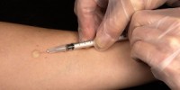 image: Opinion: A TB Vaccine Blueprint