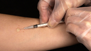 Opinion: A TB Vaccine Blueprint image: Opinion: A TB Vaccine Blueprint