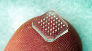 Patch with dissolving microneedles