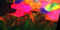 This image shows foot processes of genetically labeled cells (red) covering walls of capillaries (green) in a kidney of a mouse.Ivica Grgic, Craig R. Brooks, Andreas F. Hofmeister, Vanesa Bijol, Joseph V. Bonventre, and Benjamin D. Humphreys