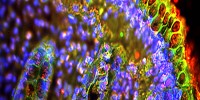 Tissue from a colon biopsy stained for the single IgG IL-1-related receptor (Sigirr) and other cellular components is shown. Therapeutic targeting of Sigirr could be useful in the treatment of inflammatory bowel disease or other inflammatory disorders of the gastrointestinal tract.Mohammed Khan, Theodore S. Steiner, Ho Pan Sham, Kirk S. Bergstrom, Jingtian T. Huang, Kiran Assi, Bill Salh, Isabella T. Tai, Xiaoxia Li, and Bruce A. Vallance