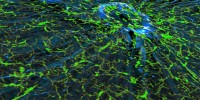 The image features nerve fibers (blue) and their attendant microglia (green), the cells responsible for immune defense in the central nervous system, as the fibers converge to form the optic nerve in a mouse retina.Alejandra Bosco and Monica L. Vetter, University of Utah, Salt Lake City, UT