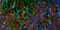 This image shows a culture of differentiated neuronal cells (green) and neural progenitor cells (red), with the nuclei of the cells in blue.Rakesh Karmacharya, Stuart L. Schreiber, and Stephen J. Haggarty, Harvard University